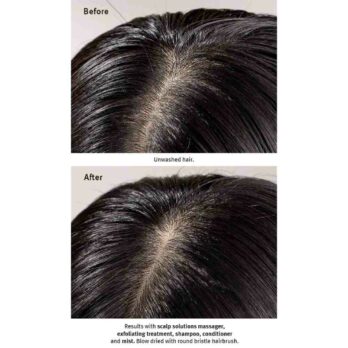 scalp solutions exfoliating treatment 12| Charm and Champagne 